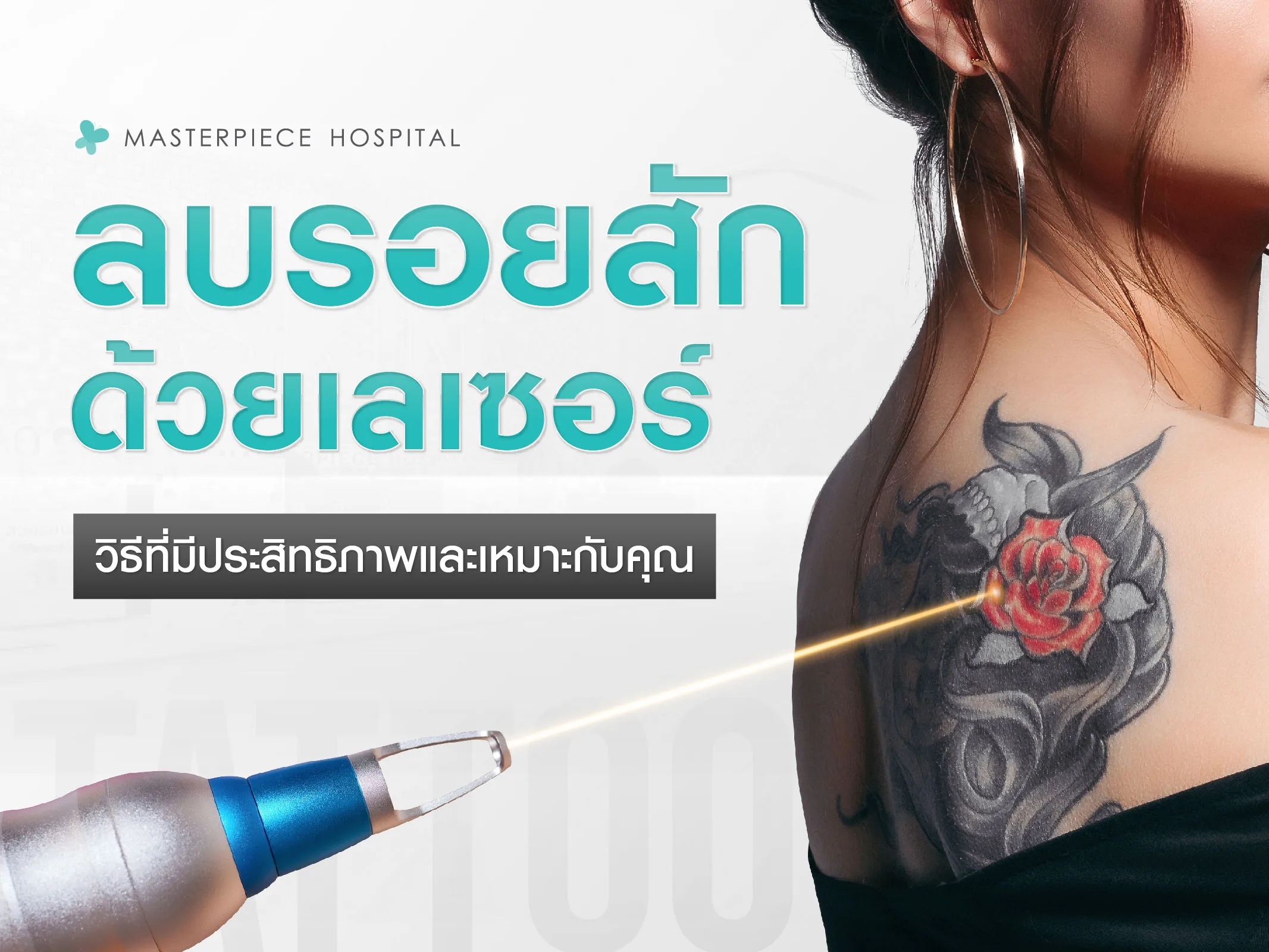 ลบรอยสักด้วยเลเซอร์: วิธีที่มีประสิทธิภาพและเหมาะกับคุณในปี 2025