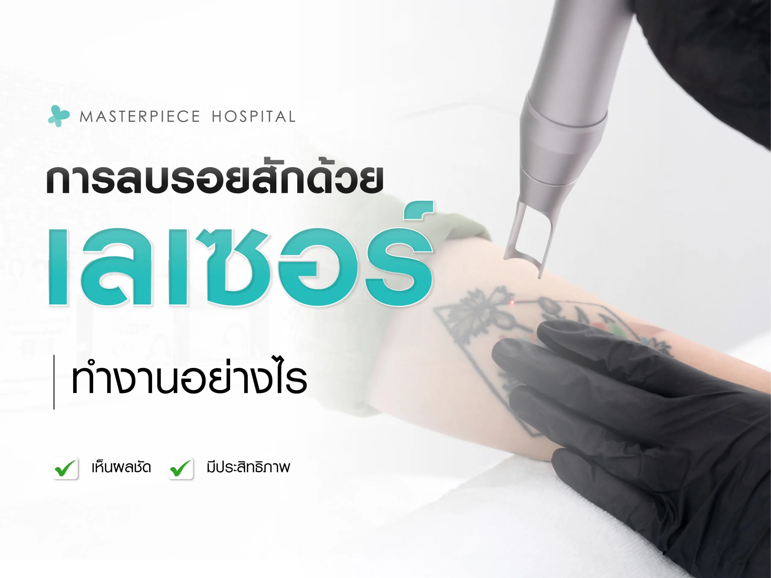 การลบรอยสักด้วยเลเซอร์ทำงานอย่างไร?