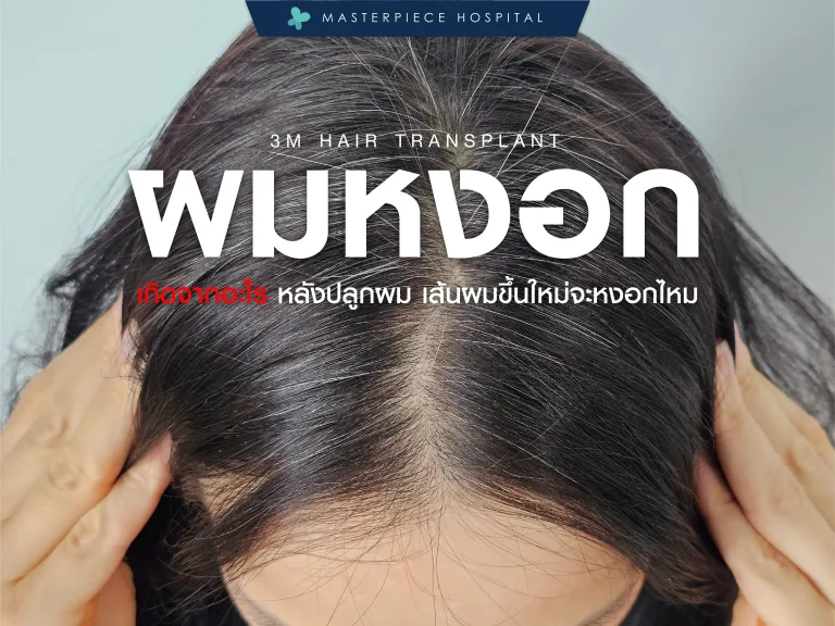 ผมหงอกเกิดจากอะไร หลังปลูกผมแล้วเส้นผมขึ้นใหม่จะหงอกไหม