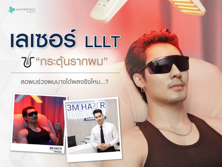 เลเซอร์กระตุ้นรากผม LLLT กระตุ้นรากผม ลดผมร่วงผมบางได้ผลจริงไหม ?