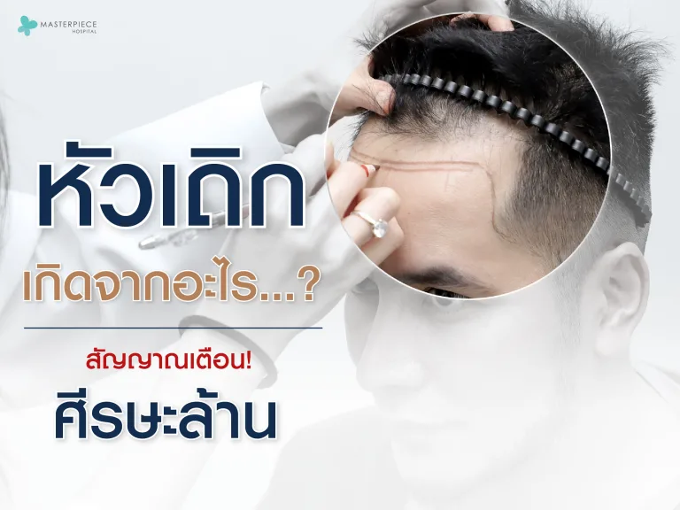 หัวเถิก เกิดจากอะไร สัญญาณเตือนศีรษะล้าน