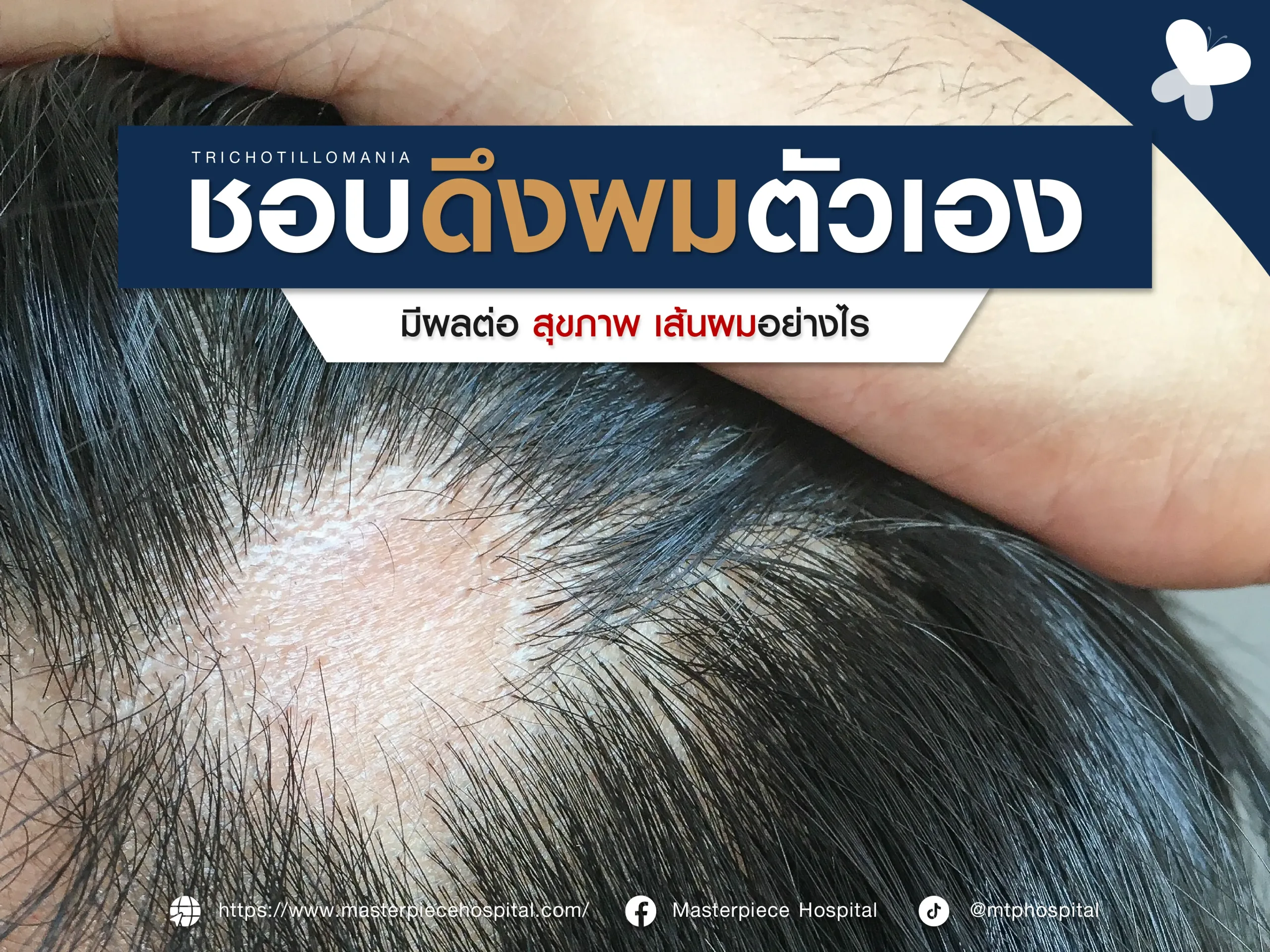 ชอบดึงผมตัวเอง มีผลต่อสุขภาพเส้นผมอย่างไร