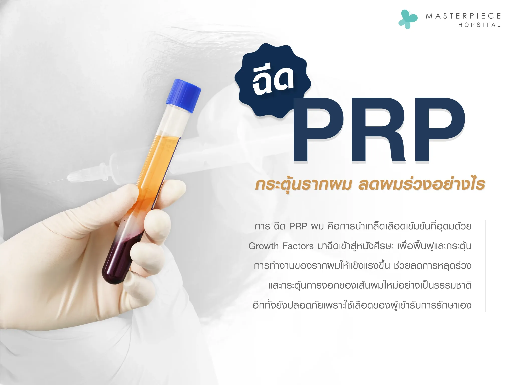 ฉีด prp ผมคืออะไร