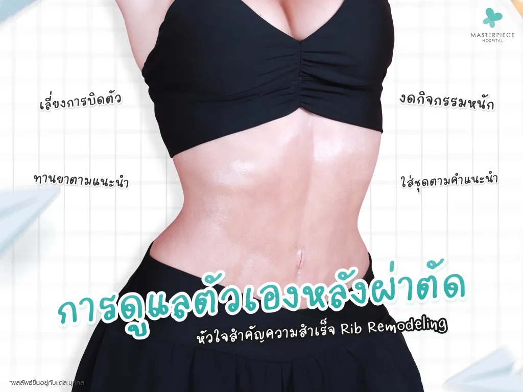 การดูแลตัวเองหลังผ่าตัด Rib modeling