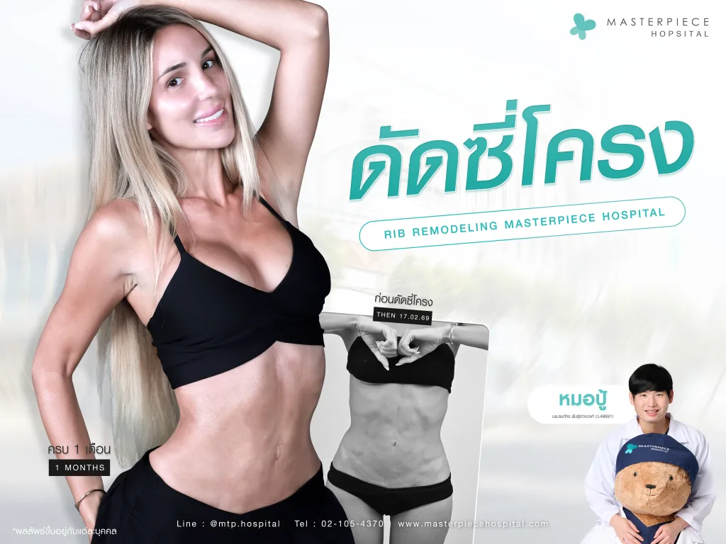 ทำ Rib Remodeling ที่ไหนดี เลือกอย่างไร