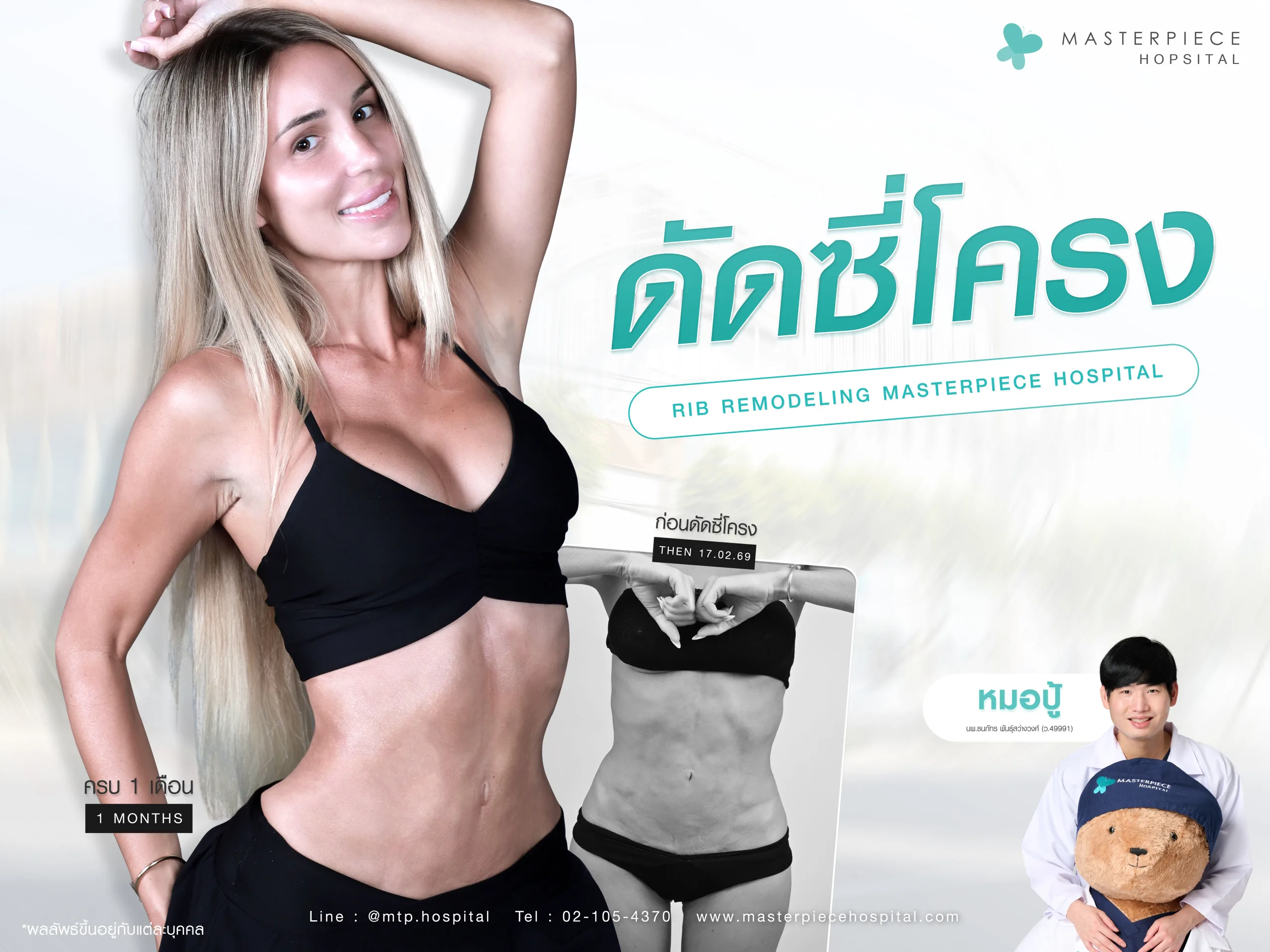 ทำ Rib Remodeling ที่ไหนดี เลือกอย่างไร