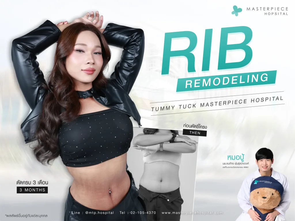 ทำ Rib Remodeling ที่ไหนดี เลือกอย่างไร