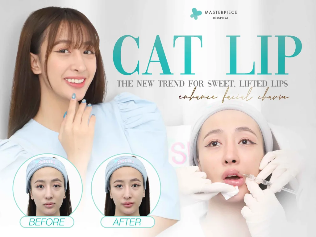 ฟิลเลอร์ปากแมว เทรนด์ใหม่ปากสวยหวาน มุมปากยก เสริมเสน่ห์ให้ใบหน้า