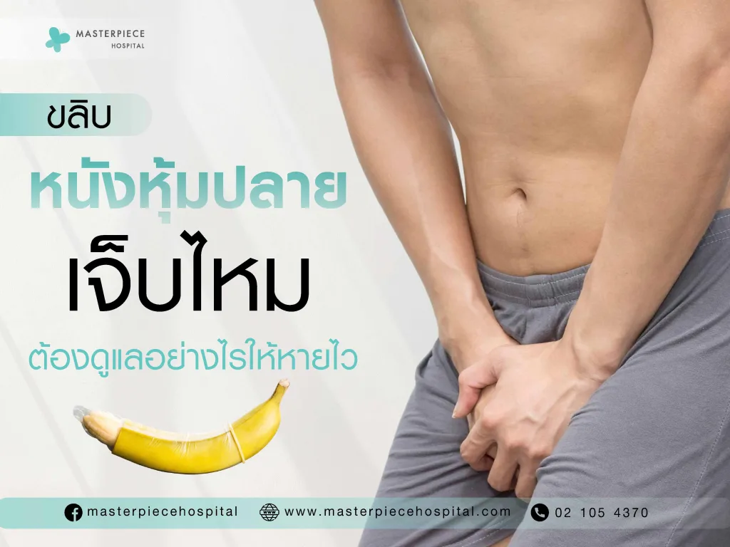 ขลิบหนังหุ้มปลายเจ็บไหม