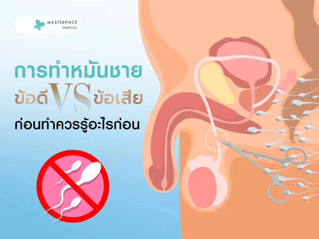 การทําหมันชายข้อดี ข้อเสียอะไรบ้าง ก่อนทำควรรู้อะไรก่อน