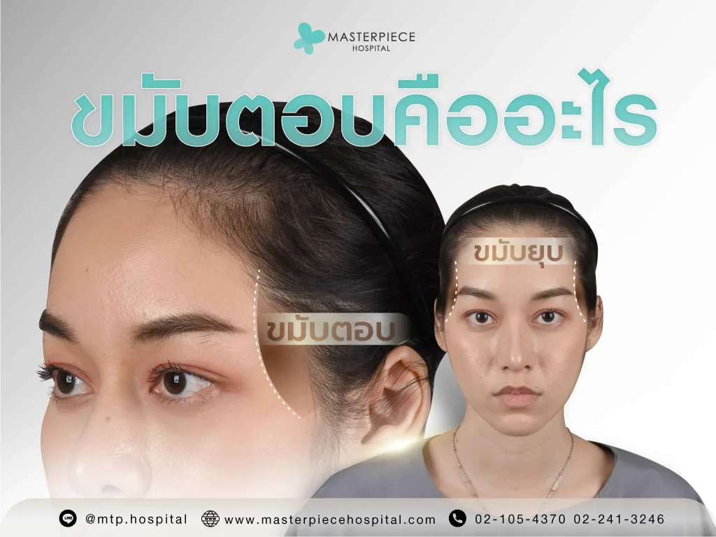 ขมับตอบคืออะไร เกิดขึ้นได้อย่างไร แก้ไขได้ด้วยวิธีไหนบ้าง