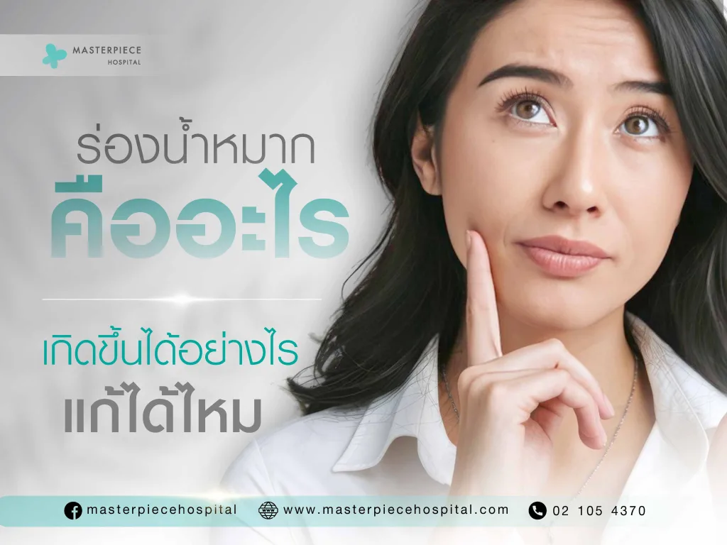 ร่องน้ำหมากคืออะไร เกิดขึ้นได้อย่างไร แก้ได้ไหม