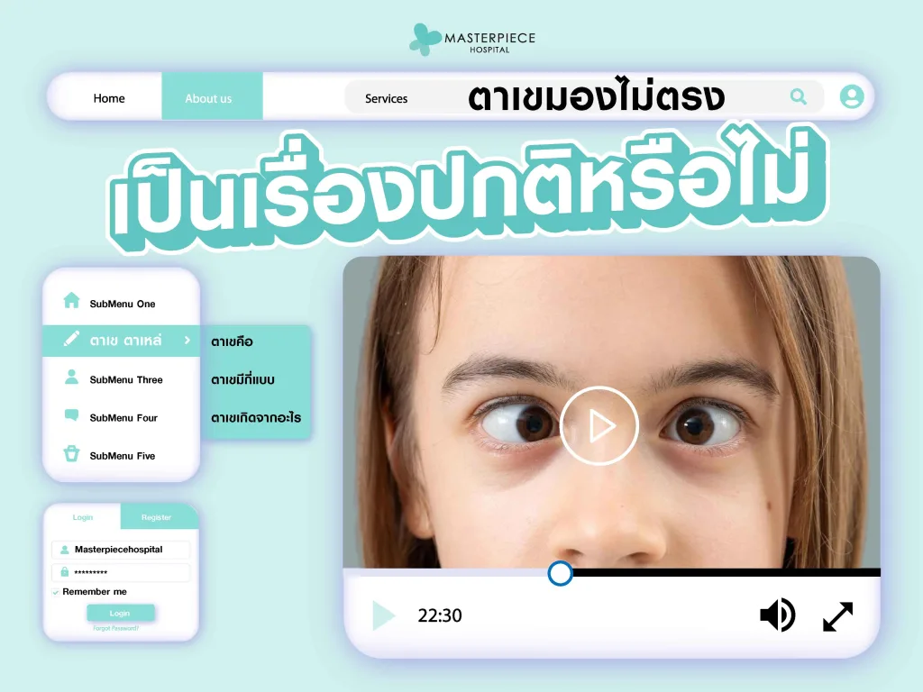 ตาเขมองไม่ตรงเป็นเรื่องปกติหรือไม่