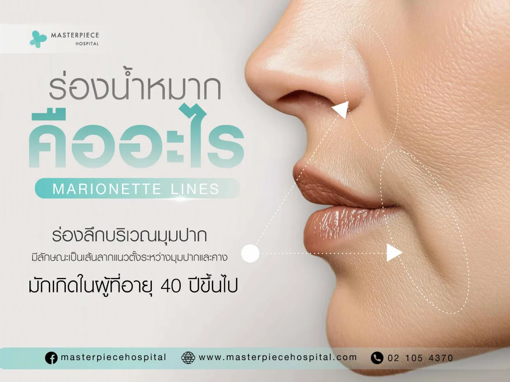 ร่องน้ำหมากคือ