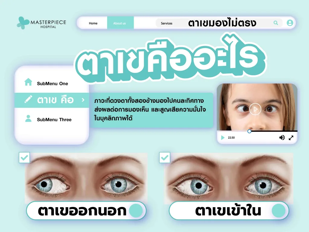 ตาเขคือ