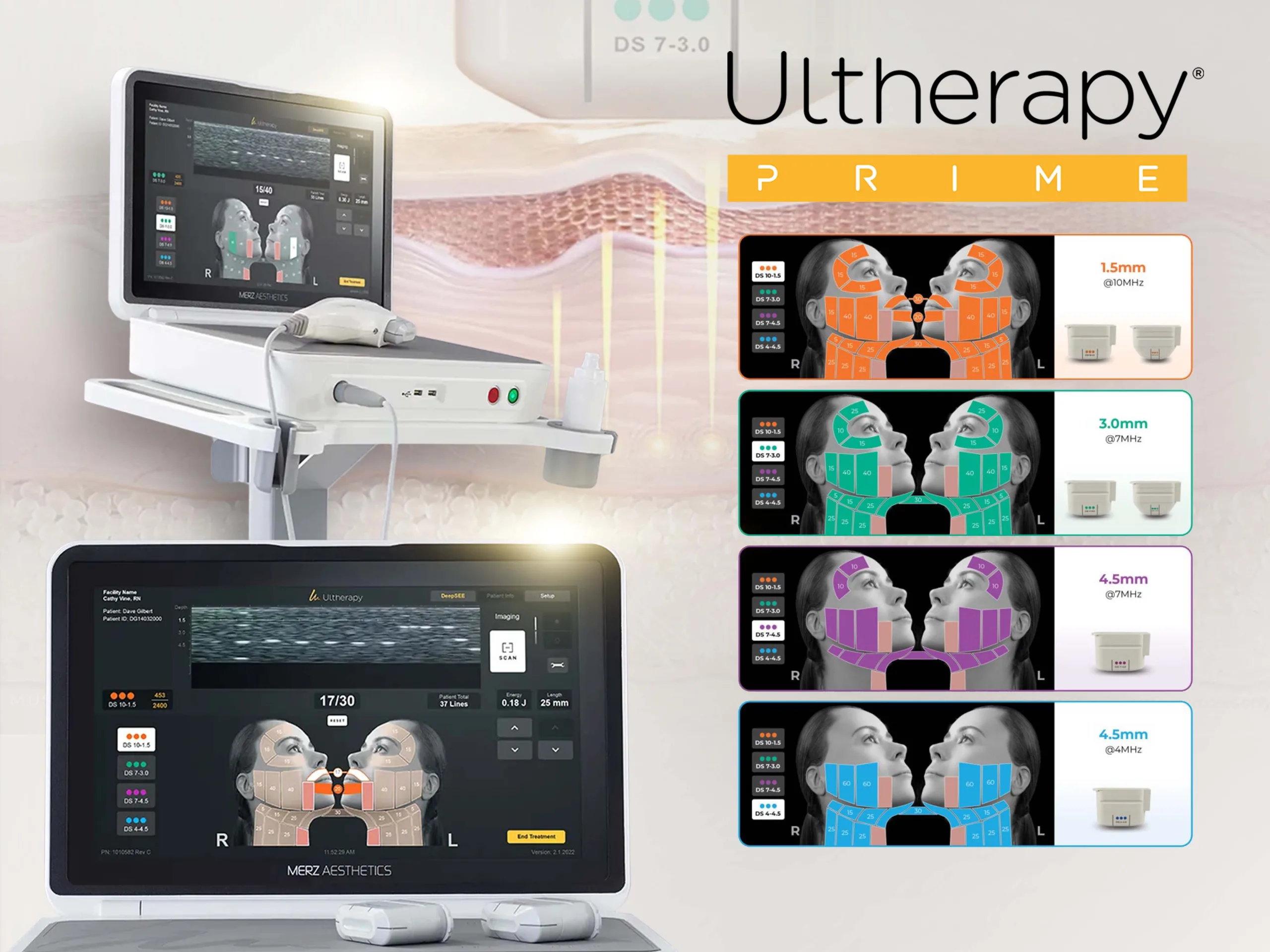 ความต่างUlthera