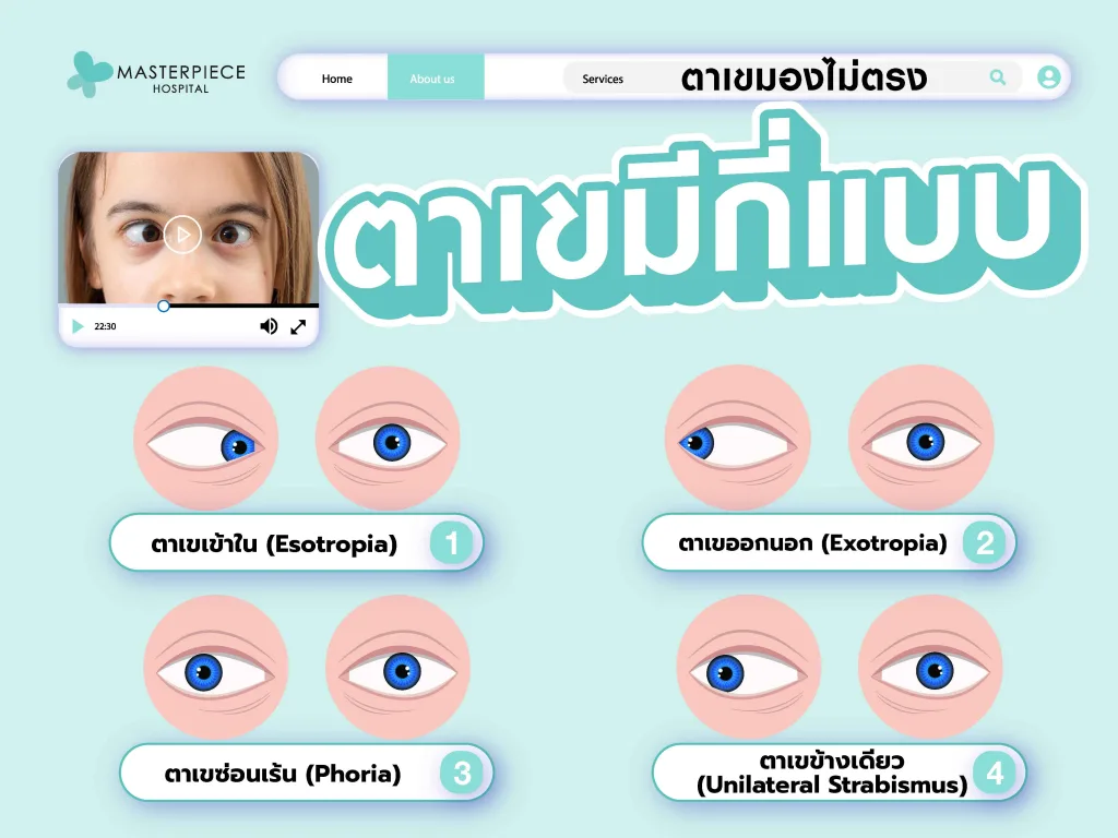 ตาเขมีกี่แบบ