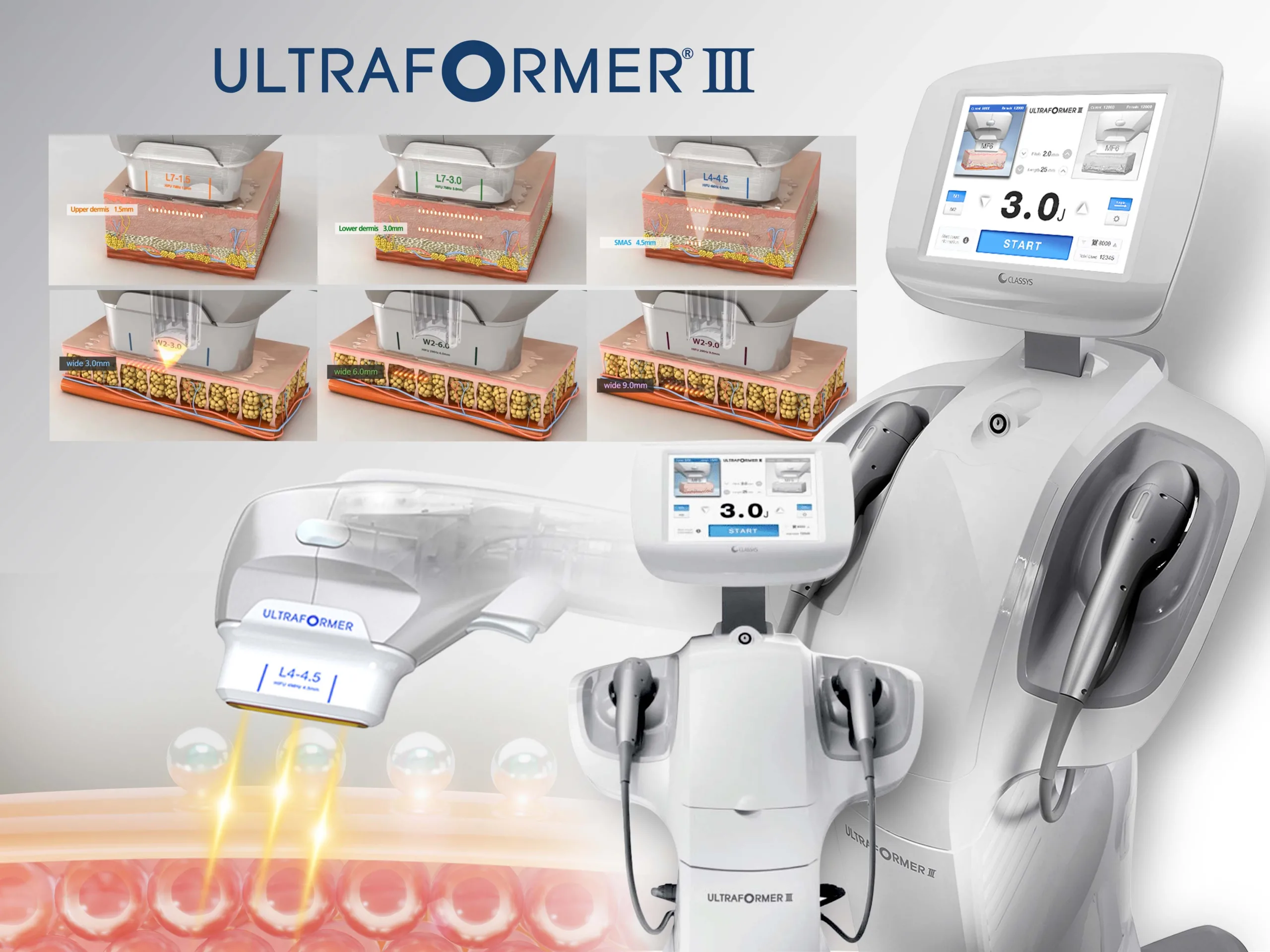 ความแตกต่างUltraformer