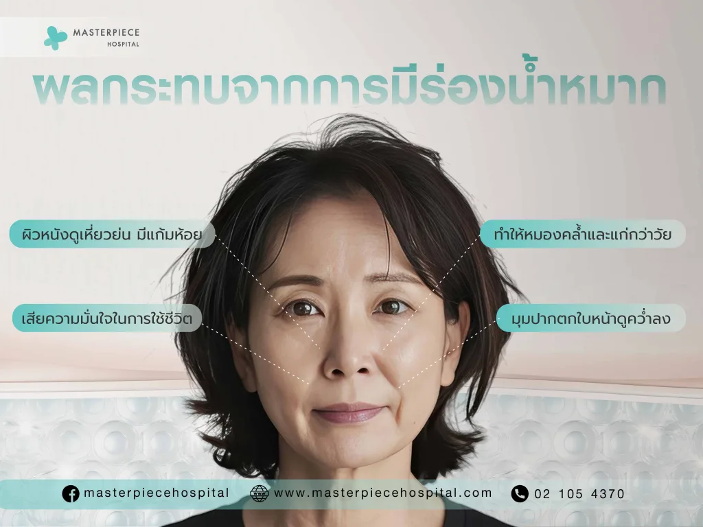 ผลกระทบจากการมีร่องน้ำหมาก