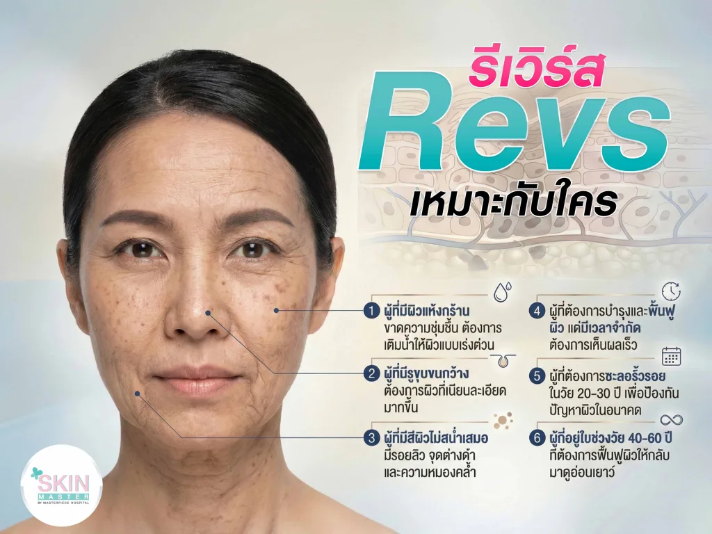 โปรแกรม Revs (รีเวิร์ส) เหมาะกับใคร