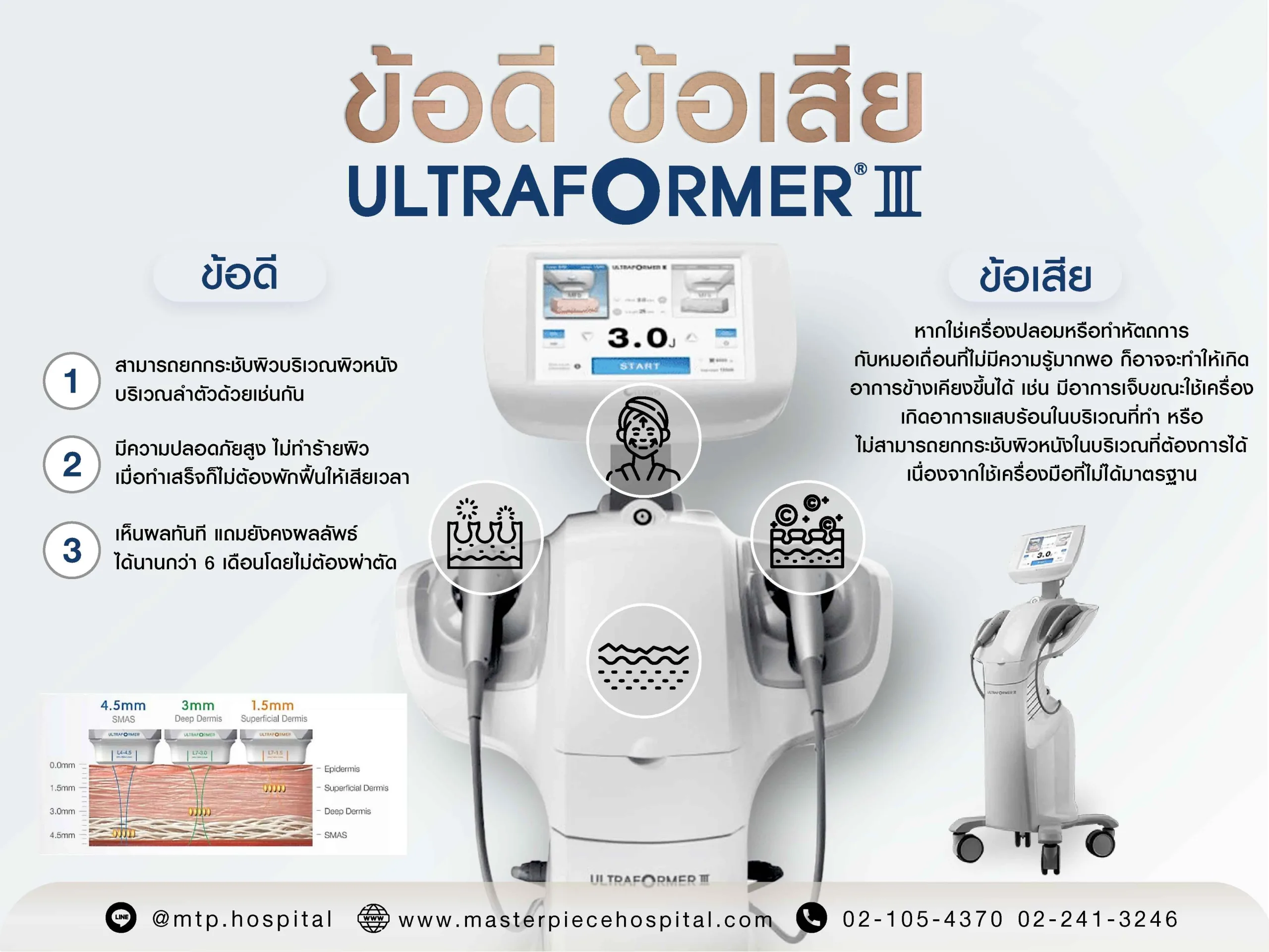 ข้อดีข้อเสียของ Ultraformer