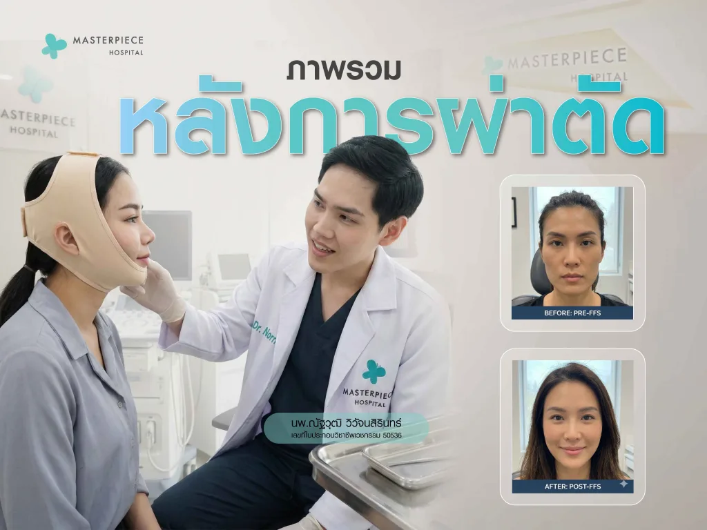 ภาพรวมการพักฟื้นหลังผ่าตัด FFS