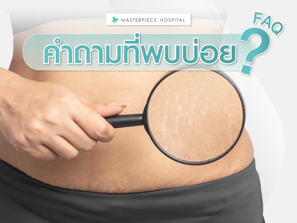 คำถามที่พบบ่อย (FAQ)