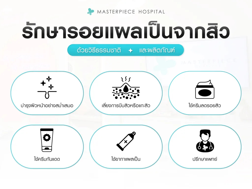 การรักษารอยแผลเป็นจากสิวด้วยวิธีธรรมชาติ และผลิตภัณฑ์