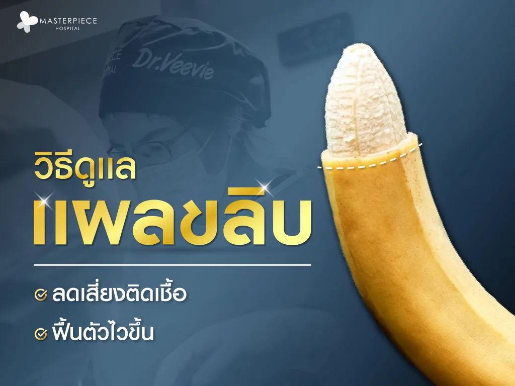 วิธีดูแลแผลหลังขลิบอย่างถูกต้อง ลดเสี่ยงติดเชื้อ ฟื้นตัวได้ไวขึ้น