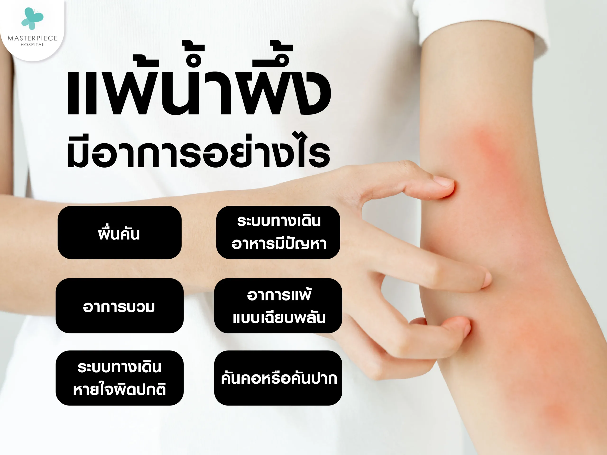 แพ้น้ำผึ้งมีอาการอะไรบ้าง