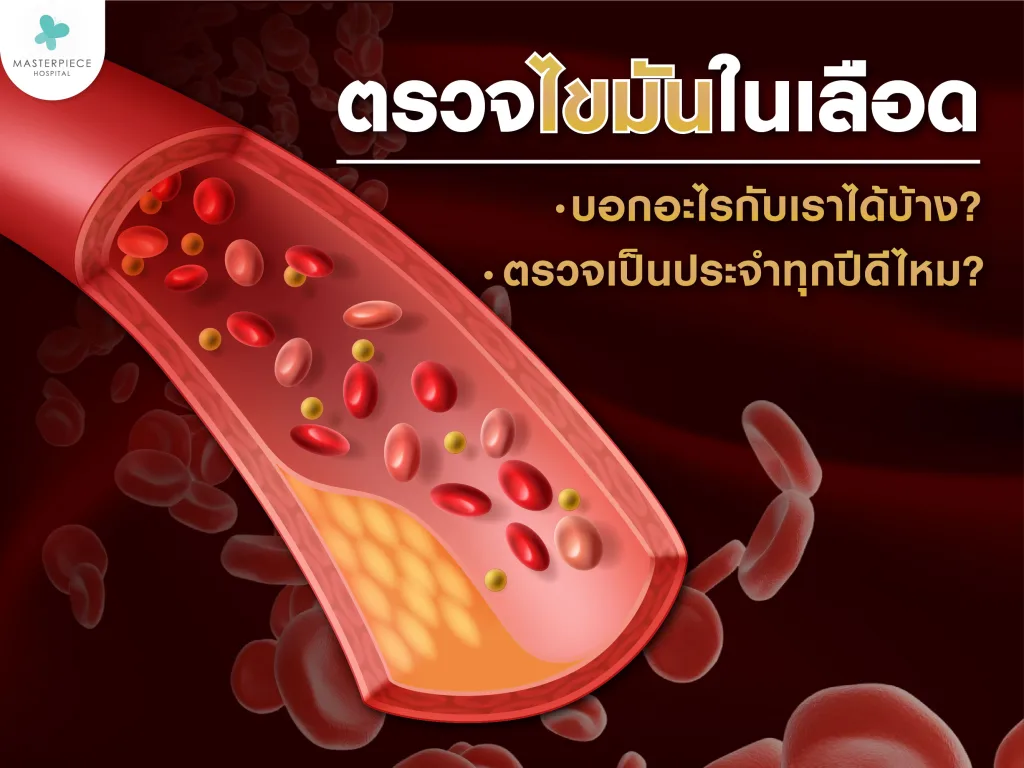 ตรวจไขมันในเลือดบอกอะไรกับเราได้บ้าง