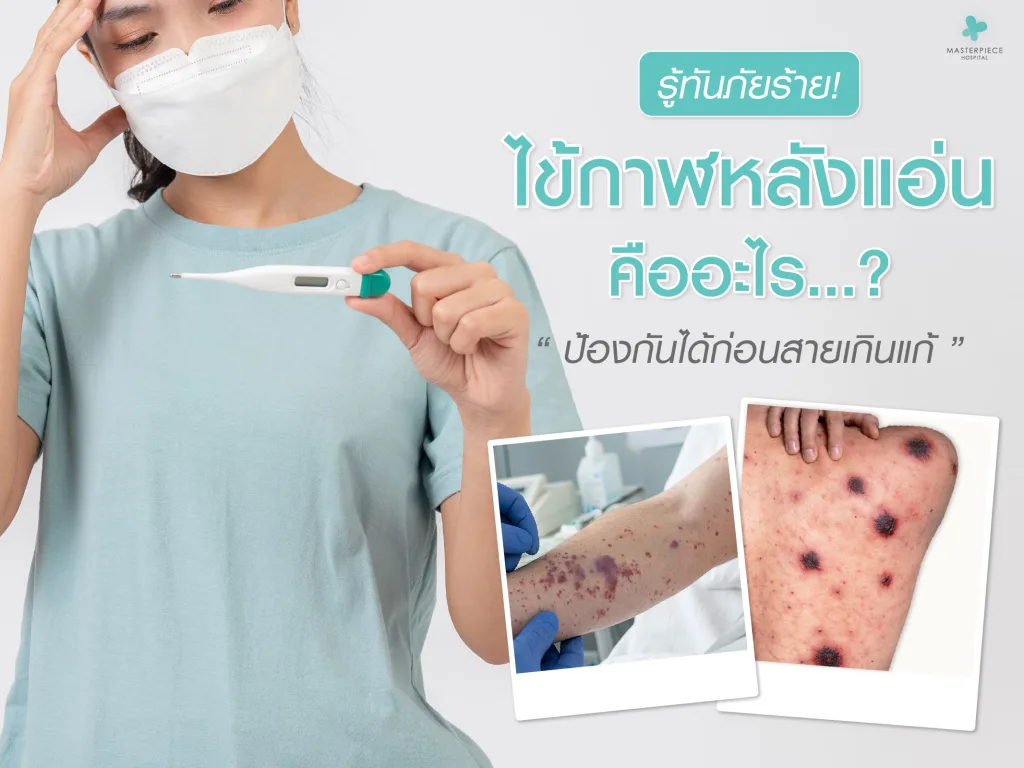 ไข้กาฬหลังแอ่นคืออะไร รู้ทันภัยร้าย ป้องกันได้ก่อนสายเกินแก้