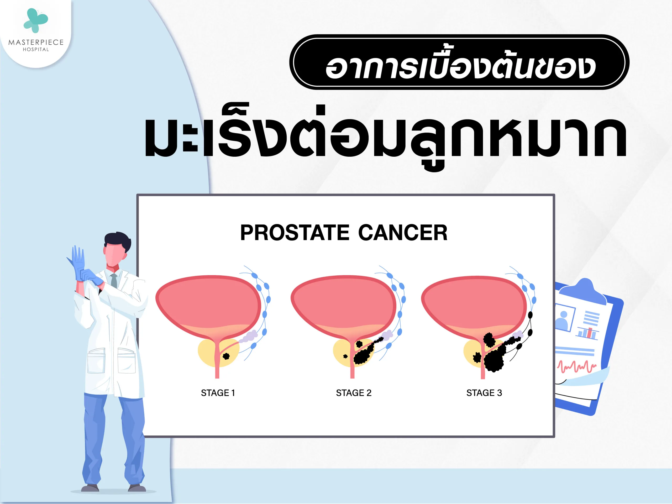 อาการเบื้องต้นของมะเร็งต่อมลูกหมาก