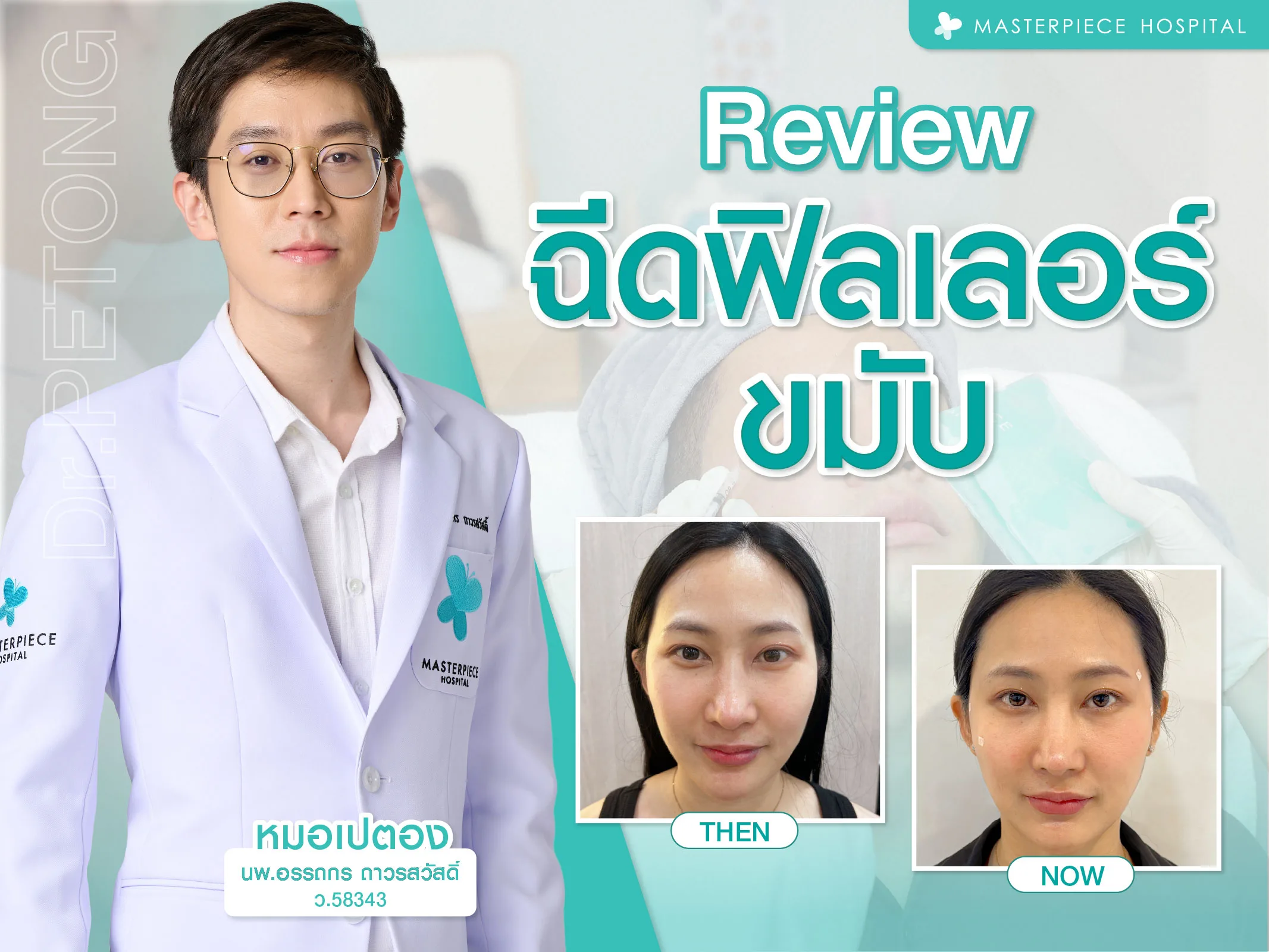 รีวิวฉีดฟิลเลอร์ขมับ