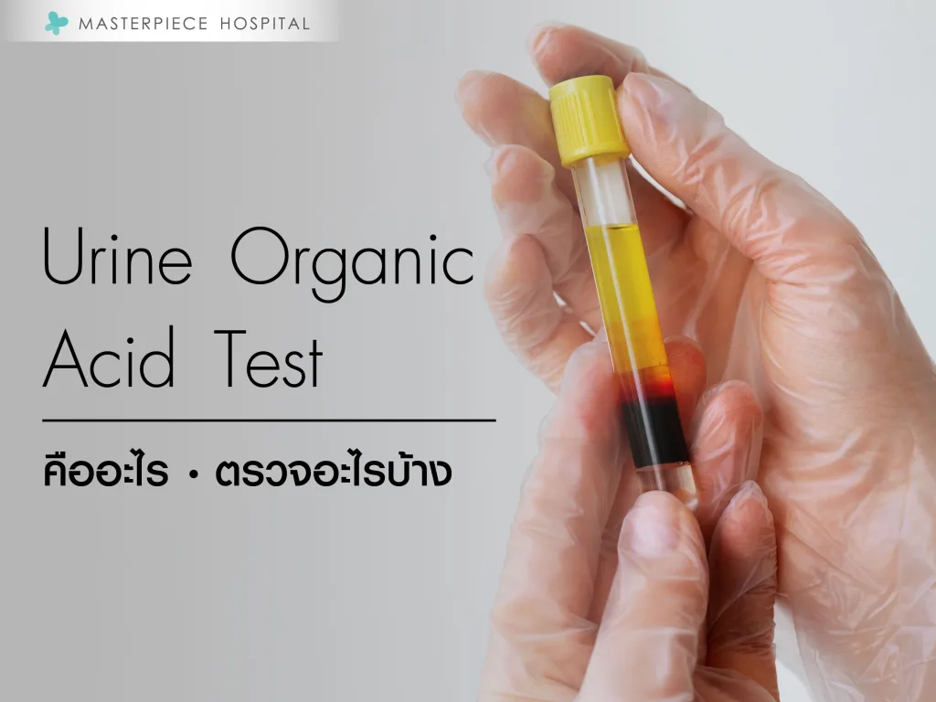 Urine organic acid test