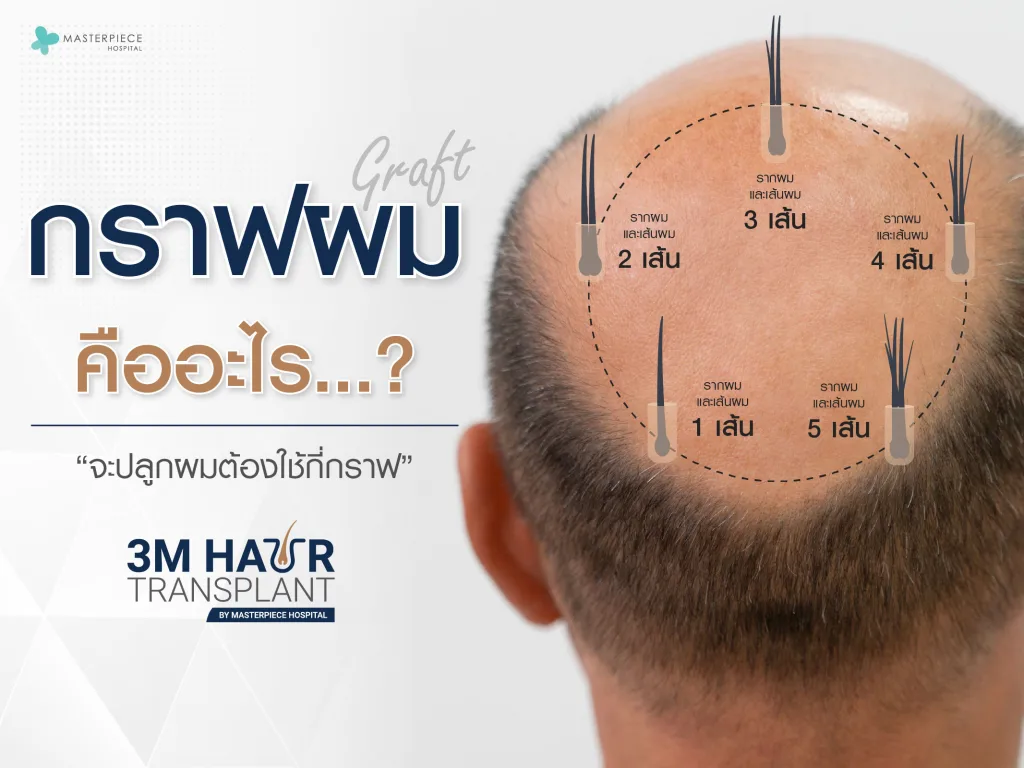 กราฟผมคืออะไร