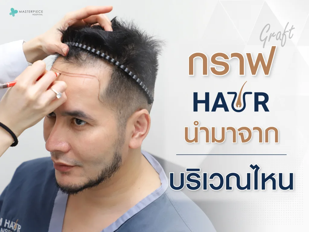 กราฟผมนำมาจากบริเวณไหน