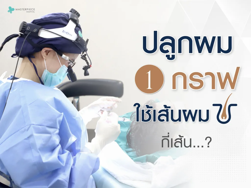 ปลูกผม 1 กราฟใช้เส้นผมกี่เส้น
