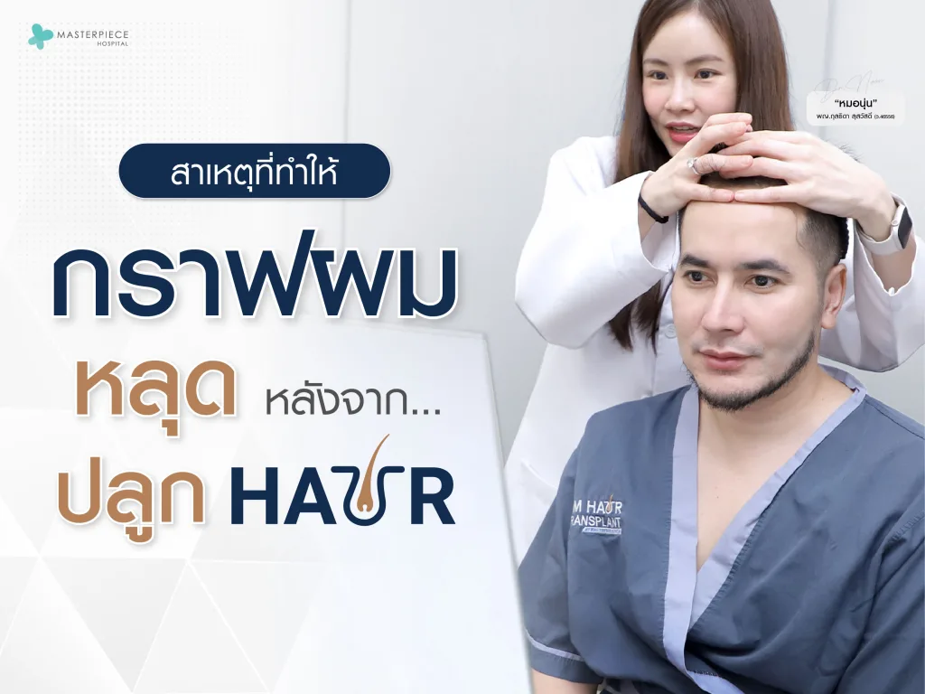 สาเหตุที่ทำให้กราฟผมหลุด หลังจากปลูกผม