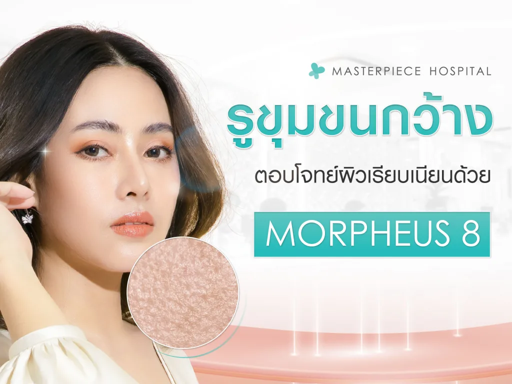 บอกลารูขุมขนกว้าง Morpheus8 ตอบโจทย์ผิวเรียบเนียน