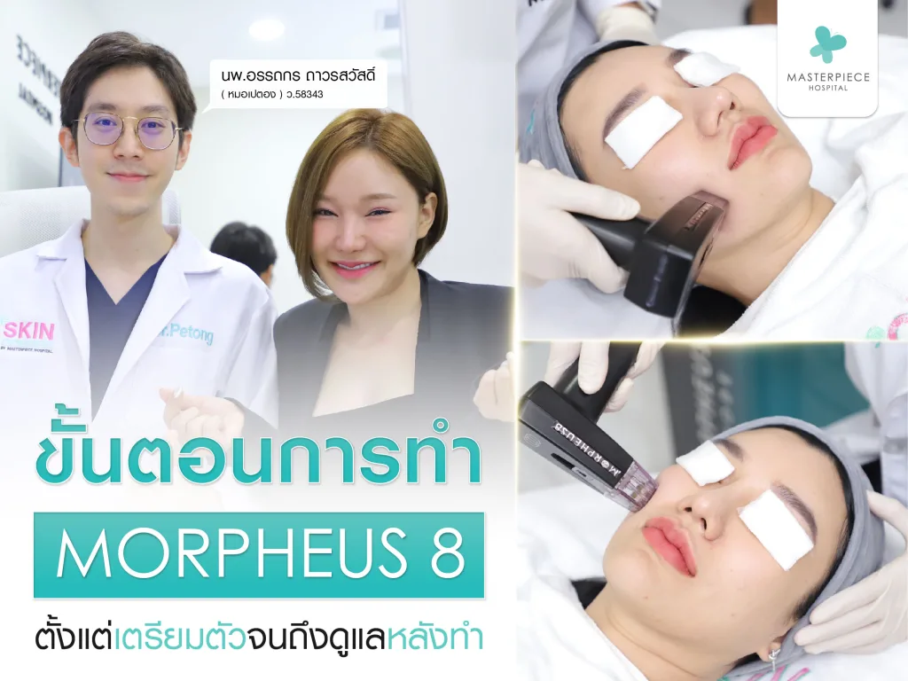 ขั้นตอนการทำ Morpheus8 เพื่อกระชับรูขุมขน ตั้งแต่เตรียมตัวจนถึงดูแลหลังทำ