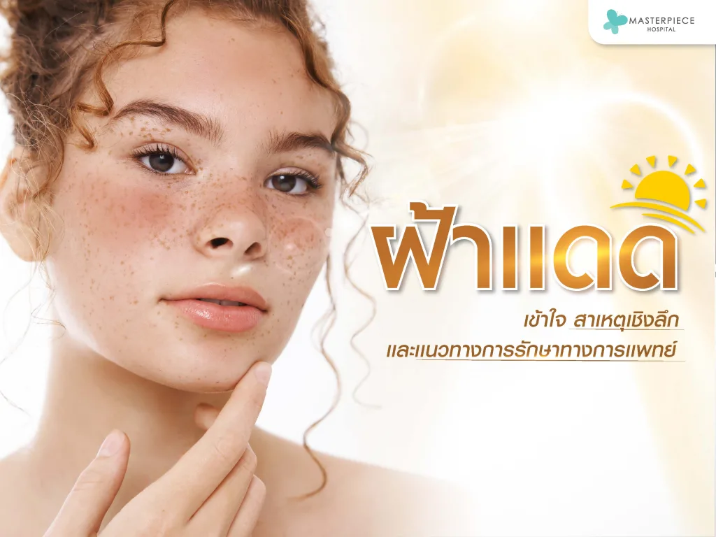 ฝ้าแดด เข้าใจสาเหตุเชิงลึก และแนวทางการรักษาทางการแพทย์