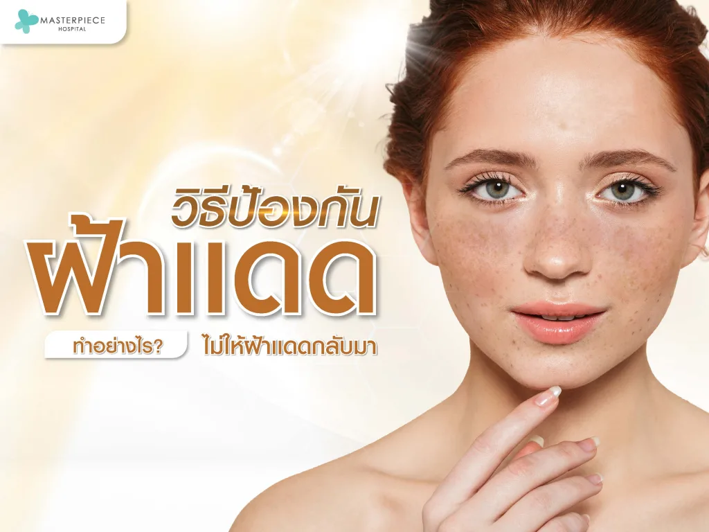 ป้องกันฝ้าแดด ทำอย่างไรไม่ให้ฝ้าแดดกลับมา