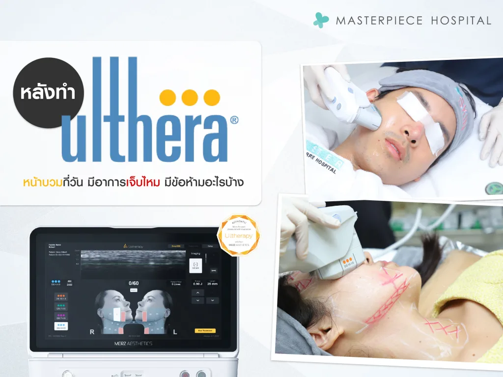 หลังทํา ulthera หน้าบวมกี่วัน มีอาการเจ็บไหม มีข้อห้ามอะไรบ้าง ?
