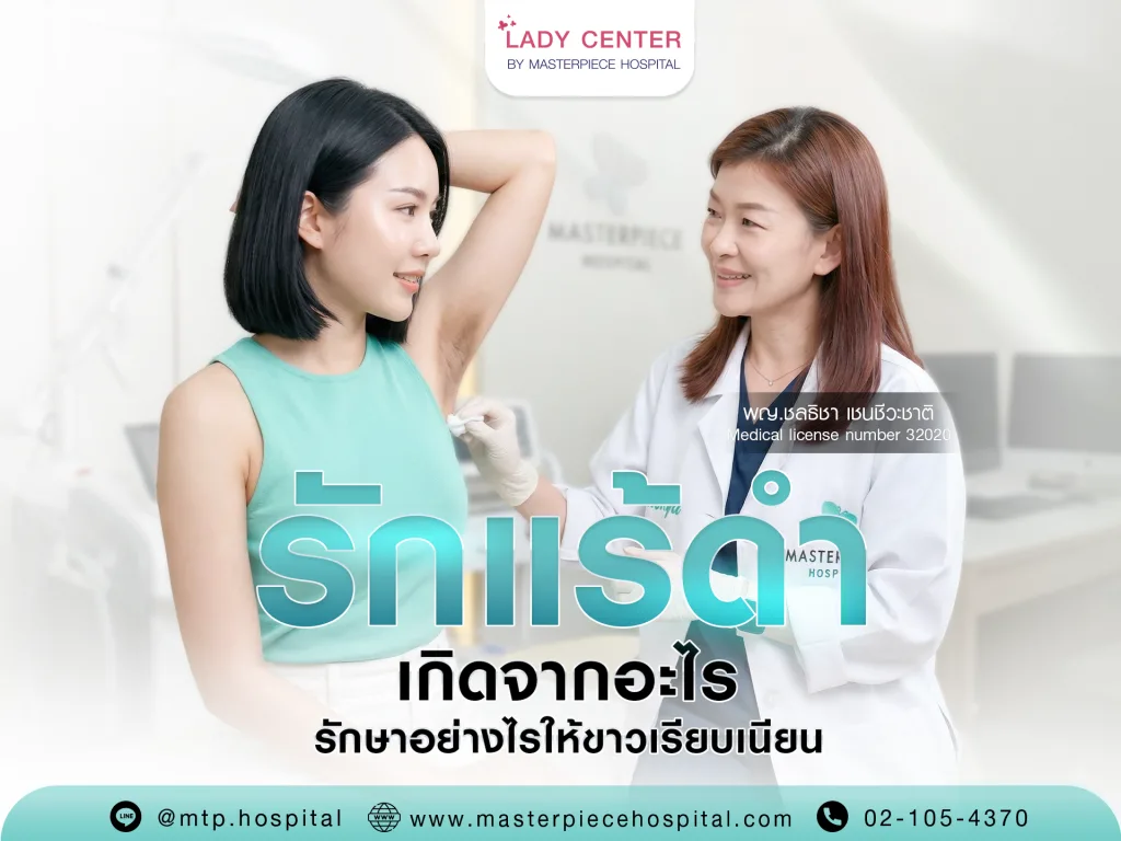 รักแร้ดำ จักแร้ดำ แก้ยังไง เกิดจากอะไร รักษาอย่างไรให้ขาวเรียบเนียน ?