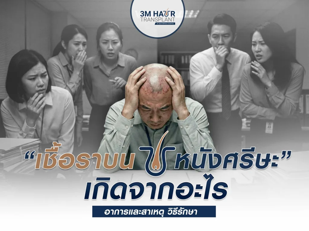 เชื้อราบนหนังศีรษะเกิดจากอะไร อาการและสาเหตุ วิธีรักษา