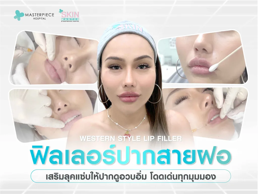 ฟิลเลอร์ปากสายฝอ เสริมลุคแซ่บให้ปากดูอวบอิ่ม โดดเด่นทุกมุมมอง