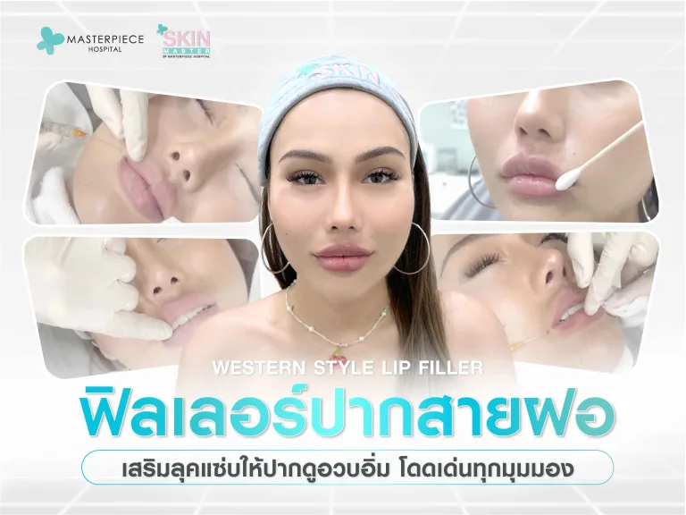 ฟิลเลอร์ปากสายฝอ เสริมลุคแซ่บให้ปากดูอวบอิ่ม โดดเด่นทุกมุมมอง