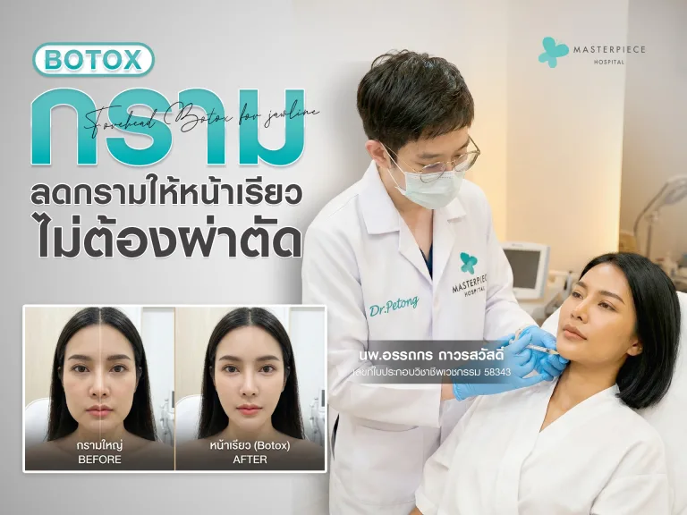 โบท็อกซ์กราม วิธีลดกรามให้หน้าเรียวแบบไม่ต้องผ่าตัด