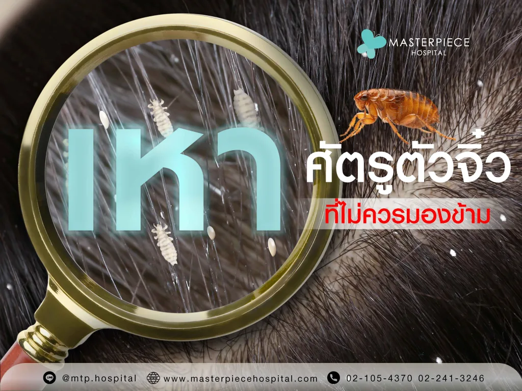 เหา ศัตรูตัวจิ๋วที่ไม่ควรมองข้าม